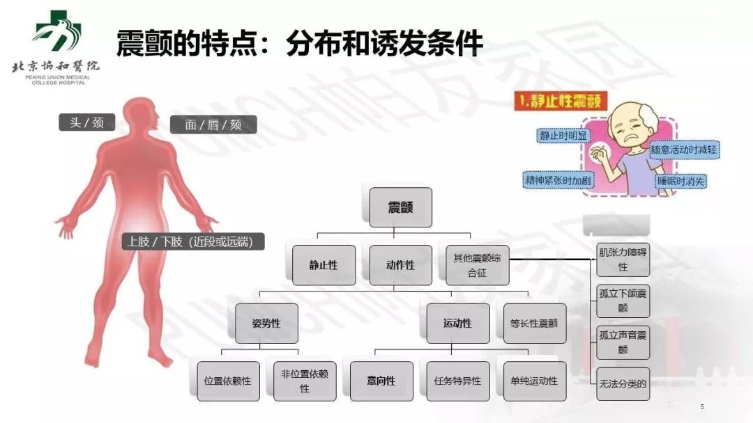 手抖就是帕金森病嗎？臨床常見的 4 個誤區(qū)